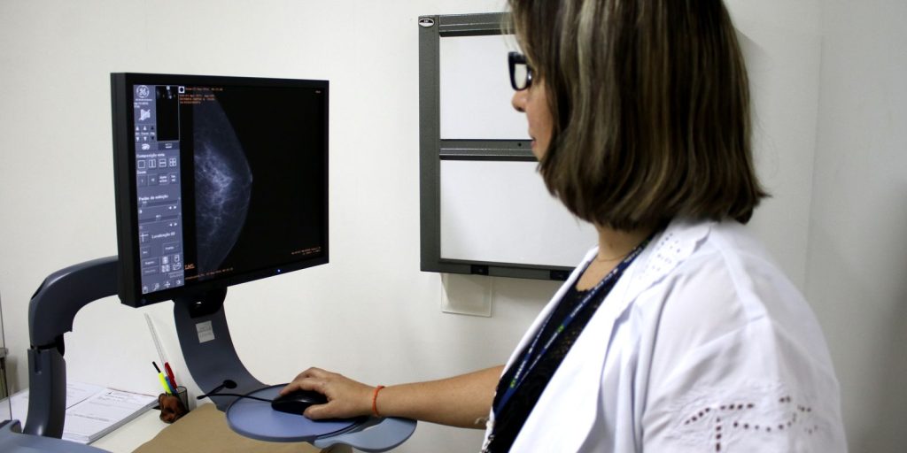 ans:-rastreio-do-cancer-de-mama-deve-ser-feito-a-partir-dos-40-anos