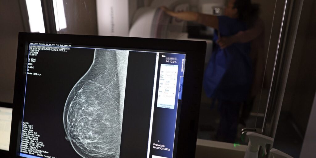 ministerio-da-saude-passa-a-recomendar-mamografia-a-partir-dos-40-anos