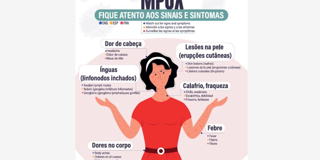 secretaria-de-saude-confirma-segundo-caso-de-mpox-do-grupo-lp-em-sp