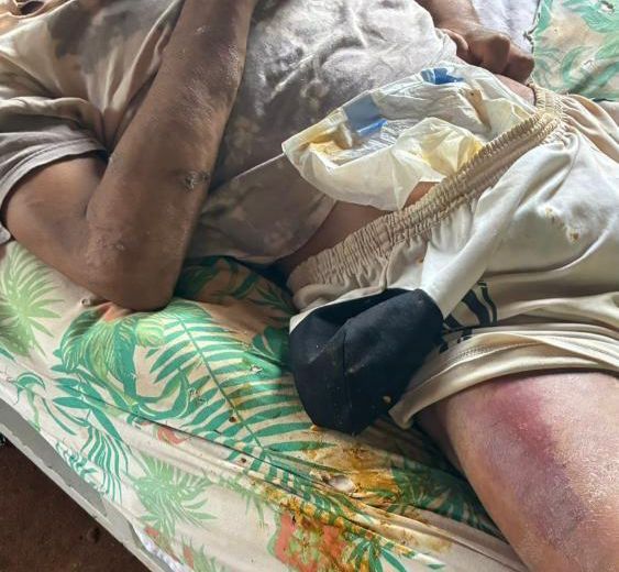 mulher-e-presa-suspeita-de-torturar-filho-acamado-em-rio-verde