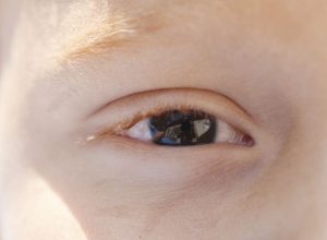 erros-de-refracao-sao-principal-causa-de-deficiencia-visual-infantil