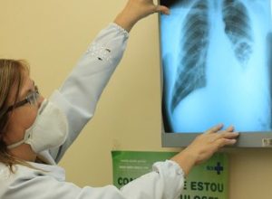 brasil-esta-na-contramao-da-meta-da-oms-para-extincao-da-tuberculose