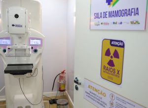 lei-garante-mamografia-pelo-sus-para-mulheres-a-partir-dos-40-anos