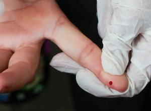 brasil-atinge-meta-de-reducao-da-transmissao-vertical-de-hepatite-b
