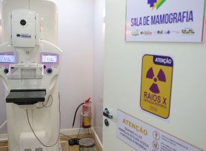 homens-costumam-descobrir-cancer-de-mama-em-estagio-mais-avancado