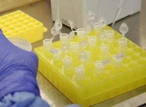 rio-confirma-dois-casos-de-sarampo-na-baixada-fluminense