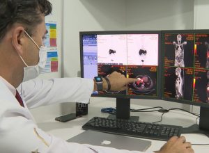 rastreamento-de-cancer-de-intestino-identifica-lesoes-em-231-pacientes