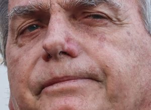 bolsonaro-apresenta-piora-clinica-e-vai-passar-por-novos-exames