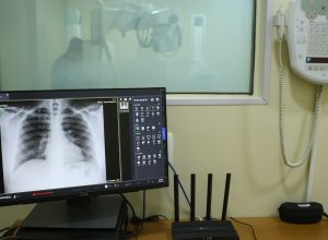 brasil-tem-aumento-de-hospitalizacoes-por-influenza-a,-alerta-fiocruz